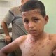 جحيمٌ صحي تحت الحصار: غزة تواجه ”طوفان” الأوبئة والأمراض الجلدية في صيف 2026