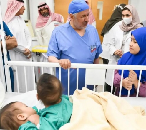 بدء عملية فصل التوأم السيامي الفلبيني «أكيزا وعائشة» بمستشفى الملك عبدالله التخصصي للأطفال بالرياض