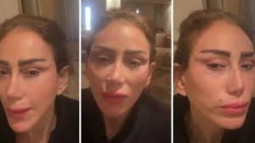 وجه مشوه وشكل بشع.. تفاصيل الحالة الصحية لريهام سعيد ..والإعلامية تهاجم نادر صعب وطبيب التجميل اللبناني يرد
